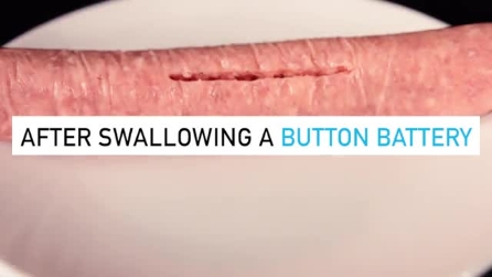 Homem coloca bateria de lítio em uma salsicha: a cena é impressionante