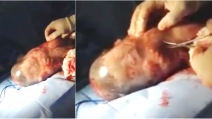 Quando si dice "nascere con la camicia", il bambino nato chiuso nel sacco amniotico