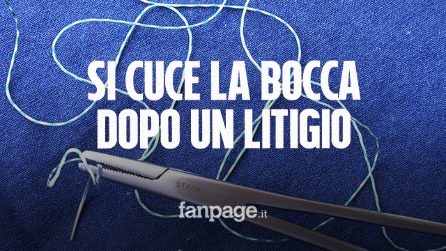 Pescara, si cuce la bocca con ago e filo dopo un litigio in un Centro accoglienza