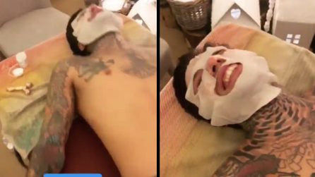 La faccia di Fedez durante il "doloroso" trattamento