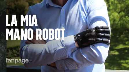 Marco e la sua mano robot: "Il sogno di ogni bambino: ora sono un po' cyborg"
