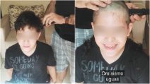 Il suo migliore amico ha il cancro: il gesto di questo bambino è una preziosa lezione d'amore